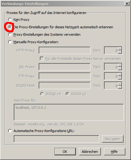 Detect the proxy settings for this network automatically